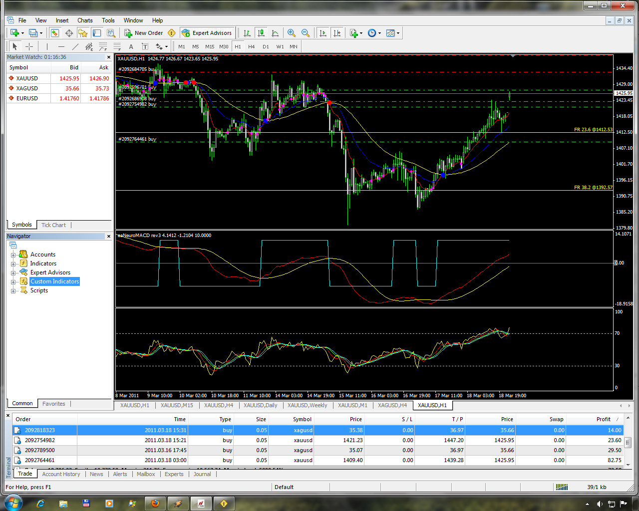 Neural dt trading systems